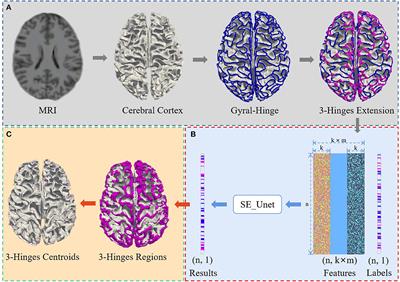 Identification for the cortical 3-Hinges folding pattern based on cortical morphological and structural features